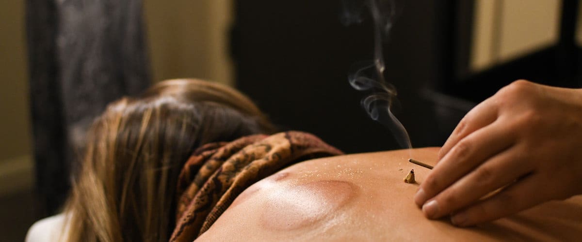 Jing Shen Healing Arts acupuncturist in Kalispell Montana performing Moxibustion
