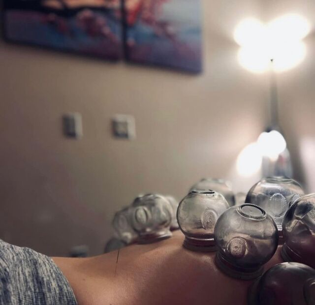 Did you know that if you are experience fatigue or low(er) energy levels, you may not be a good candidate for cupping!?! 

When you’re feeling fatigued, it can signal that your body is in a weakened state and needs gentle care to rebuild its energy. Cupping in these cases should be approached with caution to avoid overtaxing your system.

Our approach if you’re experiencing fatigue, we’ll:
✔️ Assess whether cupping is appropriate for your current state - the primary assessment happens through Chinese medicine pulse diagnosis. 
✔️ Modify the treatment to ensure it supports, rather than overwhelms, your body.
✔️ Explore other gentle therapies or techniques to help restore your energy safely.