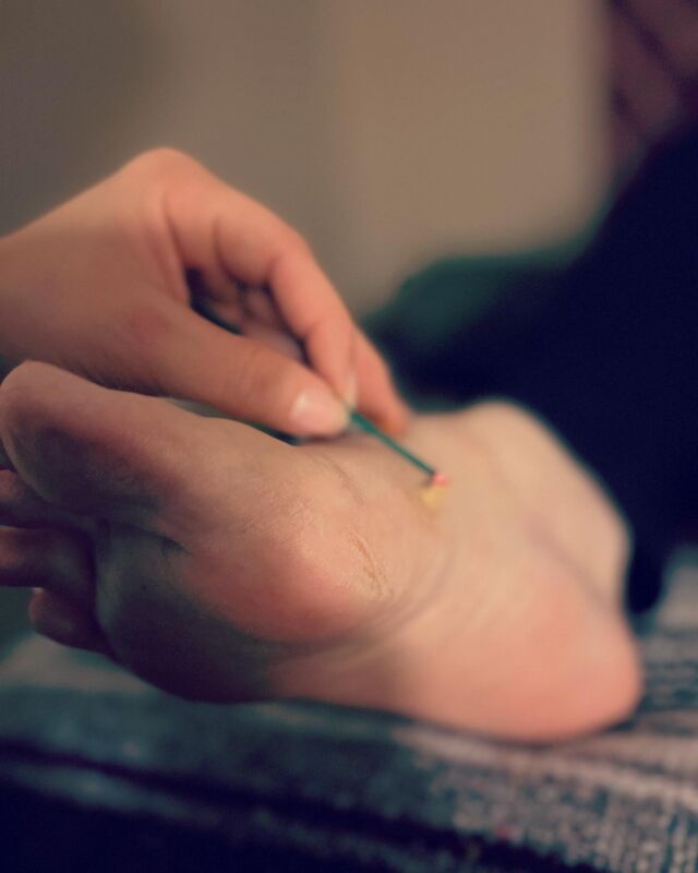 Have you ever considered exploring the wonderful world of Classical Acupuncture? This amazing holistic practice has been around for centuries, helping people just like you find balance, relief & well-being. If you're dealing with pain, stress, or other health concerns, acupuncture might be the perfect solution for you! *DM to schedule a consultation &/or to get started*