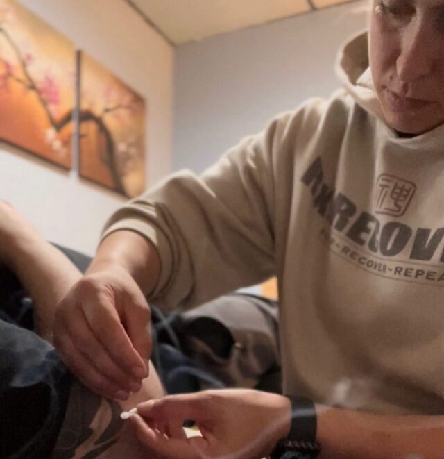 Chinese Medicine & Chronic Pain | Our clinic sees many patients suffering from chronic pain. Many come to us as a last resort, exhausted by pharmaceutical treatments and unconvinced by doctors who tell them they must simply accept their pain. Often times, these patients have tried various avenues, including other doctors, specialists, massage therapy, chiropractic care, and physical therapy & we become the last resort! 

We do witness many of these individuals achieve pain relief and successfully graduate from our care. 

FULL DISCLOSURE: These success stories typically involve a combination of treatment methods such as acupuncture, fire cupping, and sometimes traditional herbal remedies. Ultimately, we help to restore normal function and allow these individuals to return to a fulfilling life again!