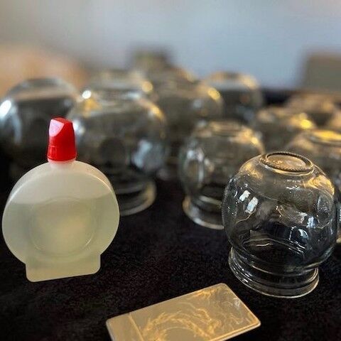 We use a traditional approach to cupping called Fire Cupping. Fire cupping involves using a flame placed within a glass cup, heating the inside of the cup to create a vacuum within the glass bulb. The cup is then placed directly on the skin over the area that needs to be cupped, causing the glass to seal over the skin.